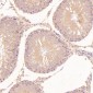Anti-GRP78 BiP HSPA5 Rabbit Monoclonal Antibody